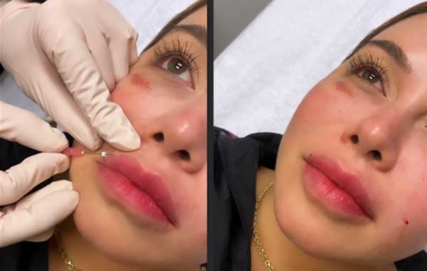 Chiquis