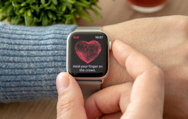 Apple-Watch