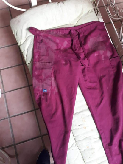 Agreden con cloro a enfermero en Reynosa 3 2 3