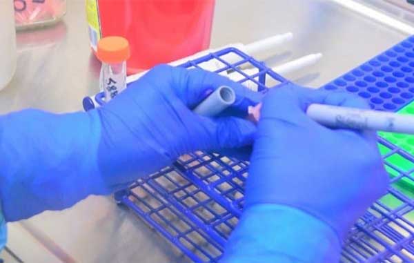 CORONAVIRUS