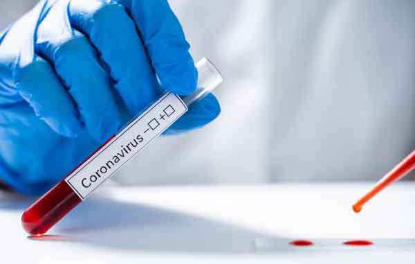 Coronavirus