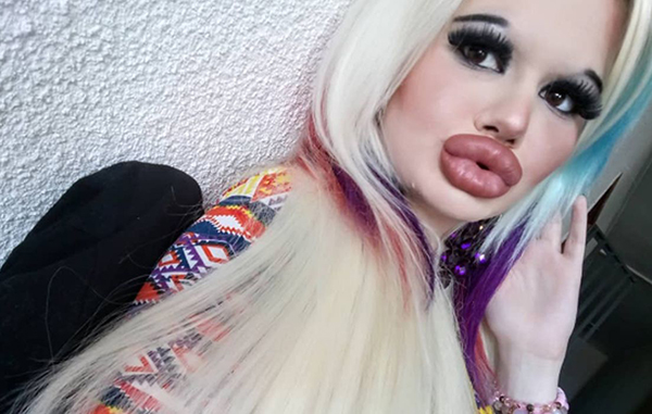 La influencer con los labios más gruesos del mundo 1 222433