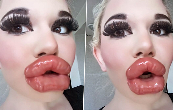 La influencer con los labios más gruesos del mundo 2 Woman Shows lips
