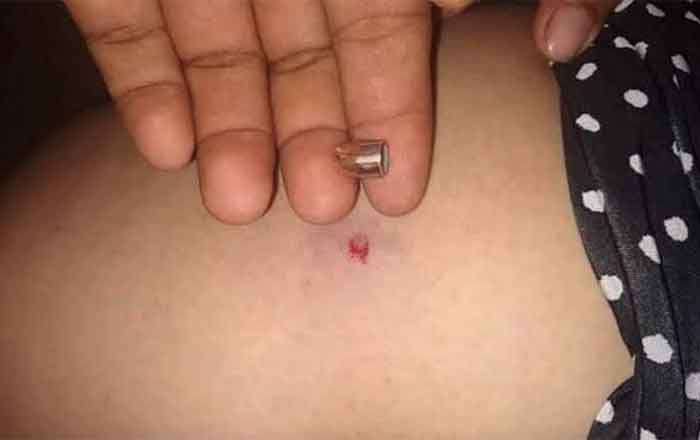 Con disparos al aire celebran año nuevo en Matamoros; lesionan a mujer 1 BALA PERDIDA