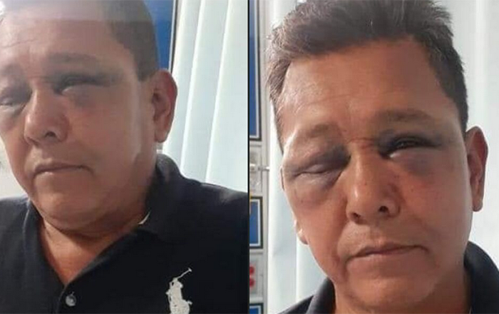Ex policía da golpiza a maestro que lo reprobó hace 20 años en Puebla 2 Captura de pantalla 2022 03 14 a las 11.18.26 a.m.
