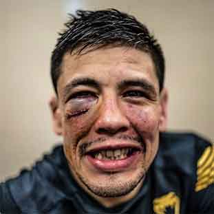 Brandon Moreno es nuevo campeón de la UFC 1 BRANDON 2