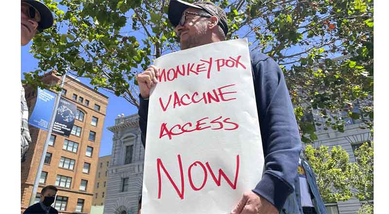 Hay estado de emergencia en San Francisco por casos de viruela símica 1 SAN FRANCISCO
