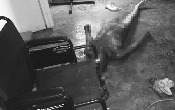 Muere hombre quemado en su domicilio 1 muerto