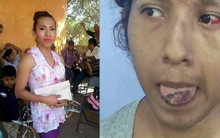 Presuntos hijos de ex edil intentan cortar lengua a joven trans 1 10263172