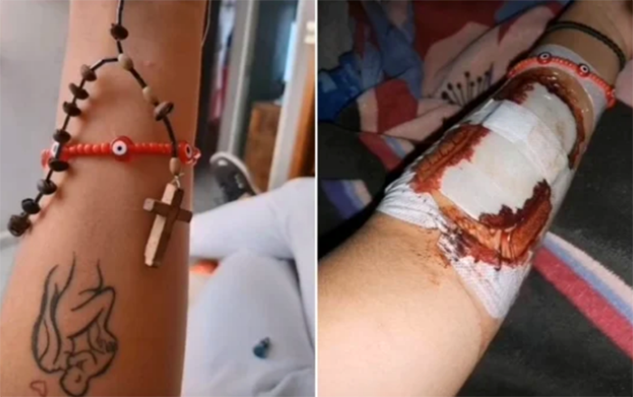 La acosan, se quita un tatuaje con bisturí y de Semar la pasan a GN 1 Captura de pantalla 2022 09 01 a las 10.54.19 a.m.
