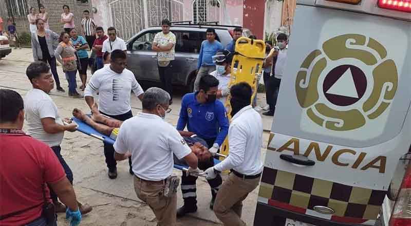 Sujeto entra a robar y pitbull casi le arranca el brazo 1 ATAQUE PITBULL 2