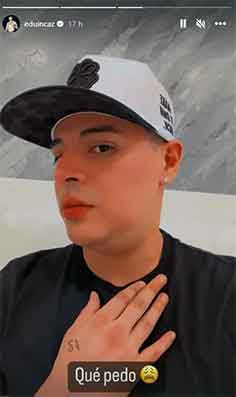 Preocupado, Eduin Caz muestra la bola que se formó en su cuello 1 EDUIN