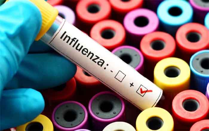 INFLUENZA