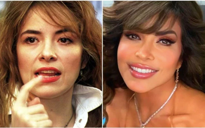 Critican labios de Gloria Trevi; le piden que ¡le pare al botox! 1 trevi