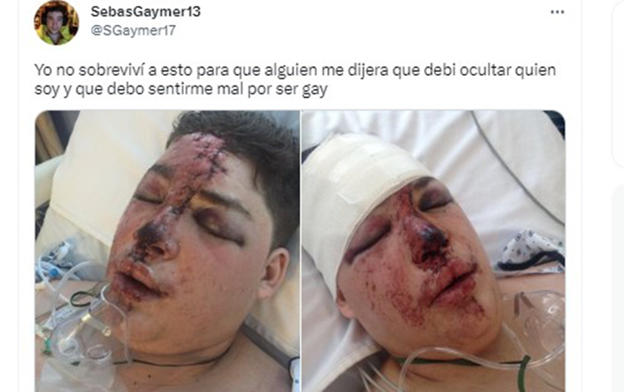 Hijo de Alfredo Adame publica fotos de su rostro golpeado de 2017 1 LZXUSKCRMNCD7NY526U3NT3LHQ