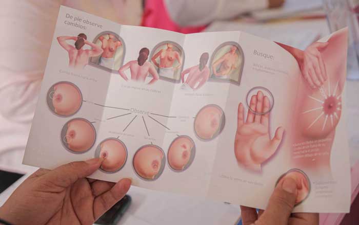 Invita DIF Tamaulipas a campaña de prevención de cáncer 1 cancer