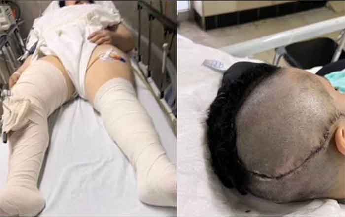 Exigen justicia por Leonor Uribe; fue golpeada por su novio 1 LEONOR 2
