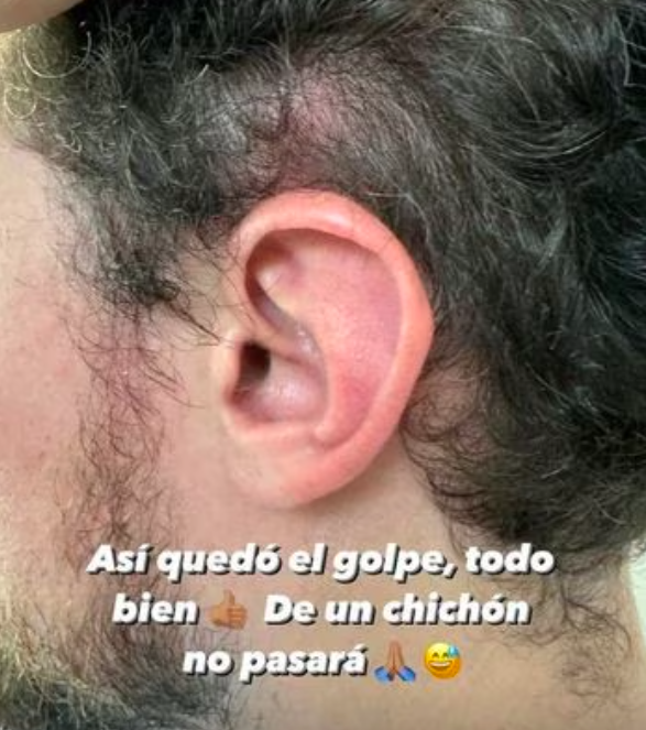 Luisito Comunica denuncia que vendedor lo golpeó en la calle 2 Captura de pantalla 2023 09 13 a las 4.29.47 p. m