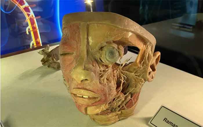 Sorprende expo 'Bodies: Cuerpos Humanos Reales' 2 CABEZA