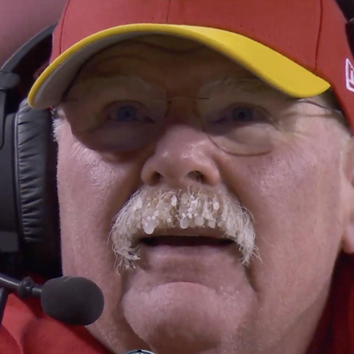 Sufrirán amputaciones aficionados de Kansas City por congelamiento 2 415785271 7013304052079103 7162827892833863639 n