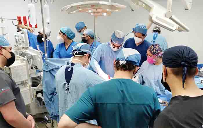 OPERACION