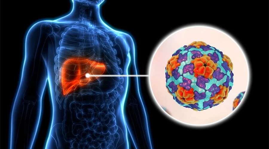 HEPATITIS C ok 23