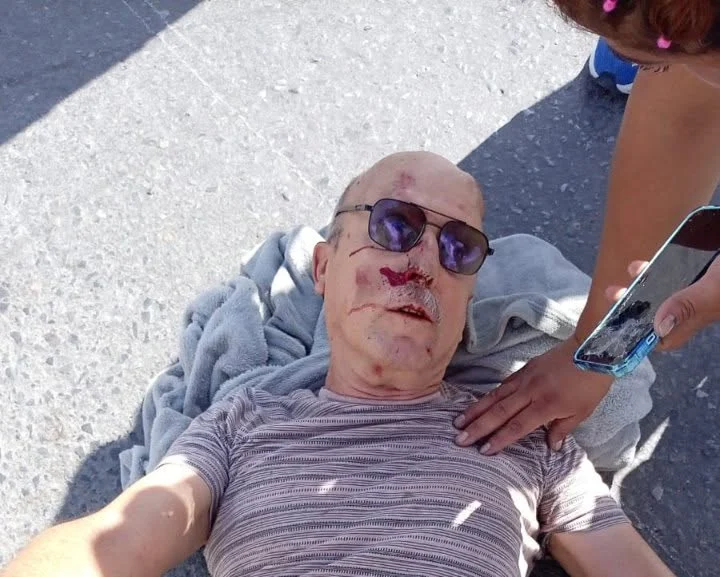 Atropellan a profesor; piden localizar a sus familiares 1 720760518 1681001146176354 6428755023343578443 n