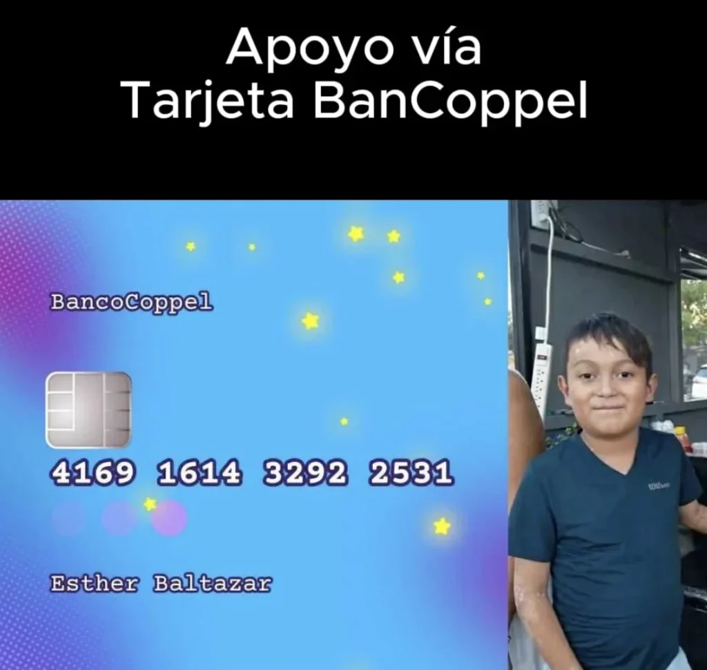 Sin cura pero con esperanza: Brayan, el niño con piel de mariposa 1 Captura de pantalla 2026 06 24 a las 5.01.11 p.m