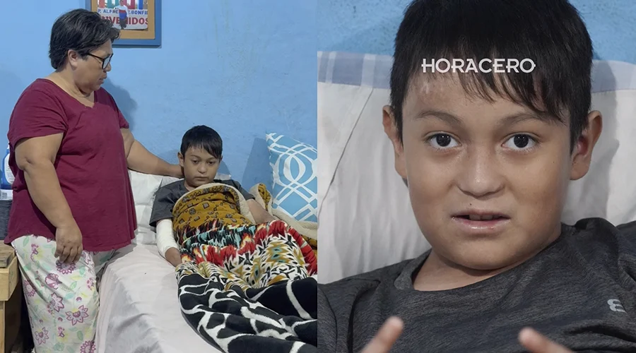 sin-cura-pero-con-esperanza-brayan-el-nino-con-piel-de-mariposa