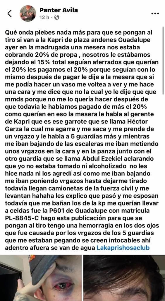 Denuncia agresión de guardias en antro; no es el primer incidente 2 813877681 4598604937129474 2541221607319732292 n