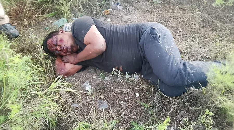 huellas-de-violencia-san-fernando Corporaciones de seguridad atienden reporte donde localizan a hombre con huellas de violencia